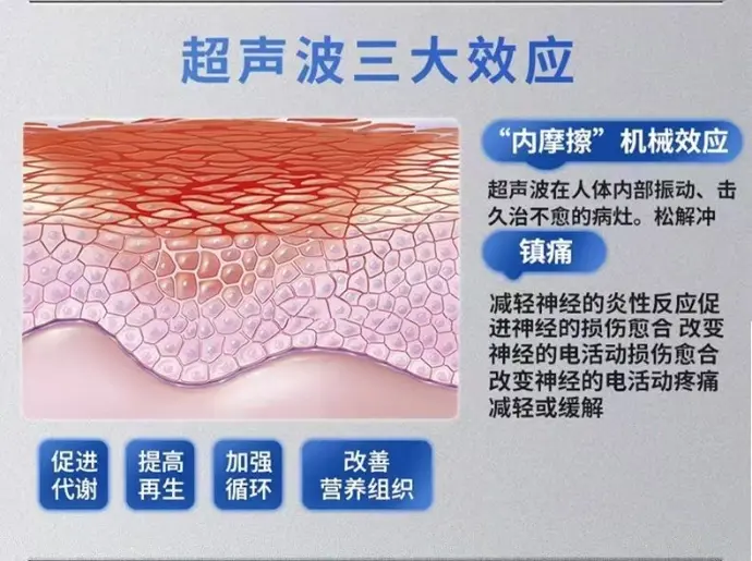 超声波理疗治疗